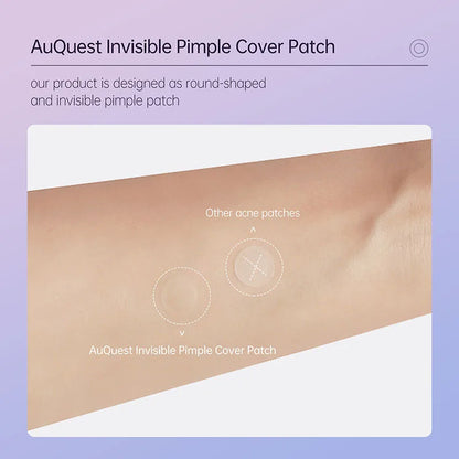 AUQUEST Invisible Zit Patch - Buy 1 Get 2 for Clear, Confident Skin